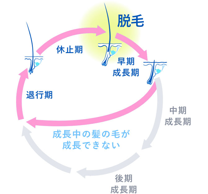 乱れたヘアサイクルのイメージ