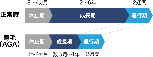 薄毛（AGA）の症状