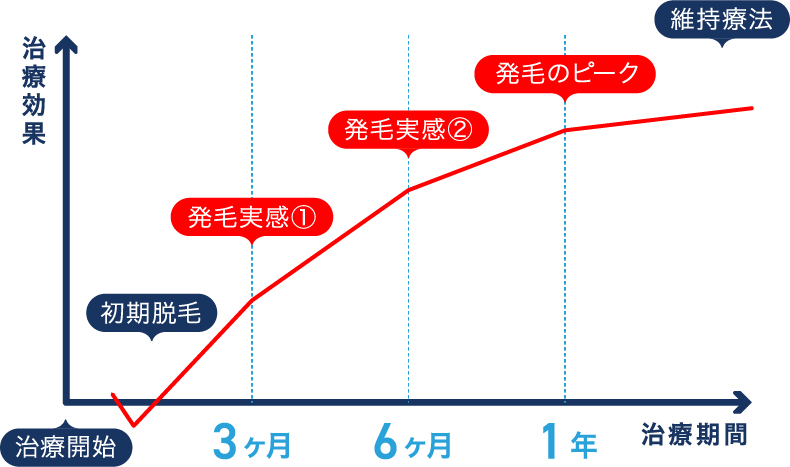 薄毛治療のモデルケース 治療のゴールまで
