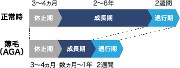 薄毛（AGA）の症状