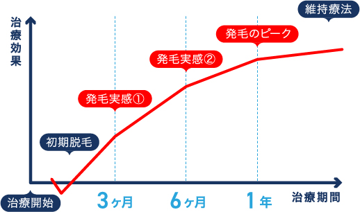 薄毛治療のモデルケース 治療のゴールまで