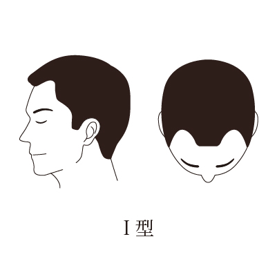 1型