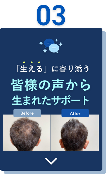 「生える」に寄り添う皆様の声から生まれたサポート