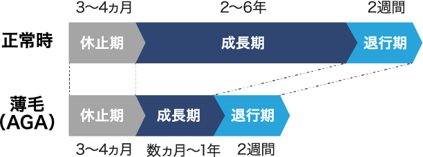 薄毛（AGA）の症状