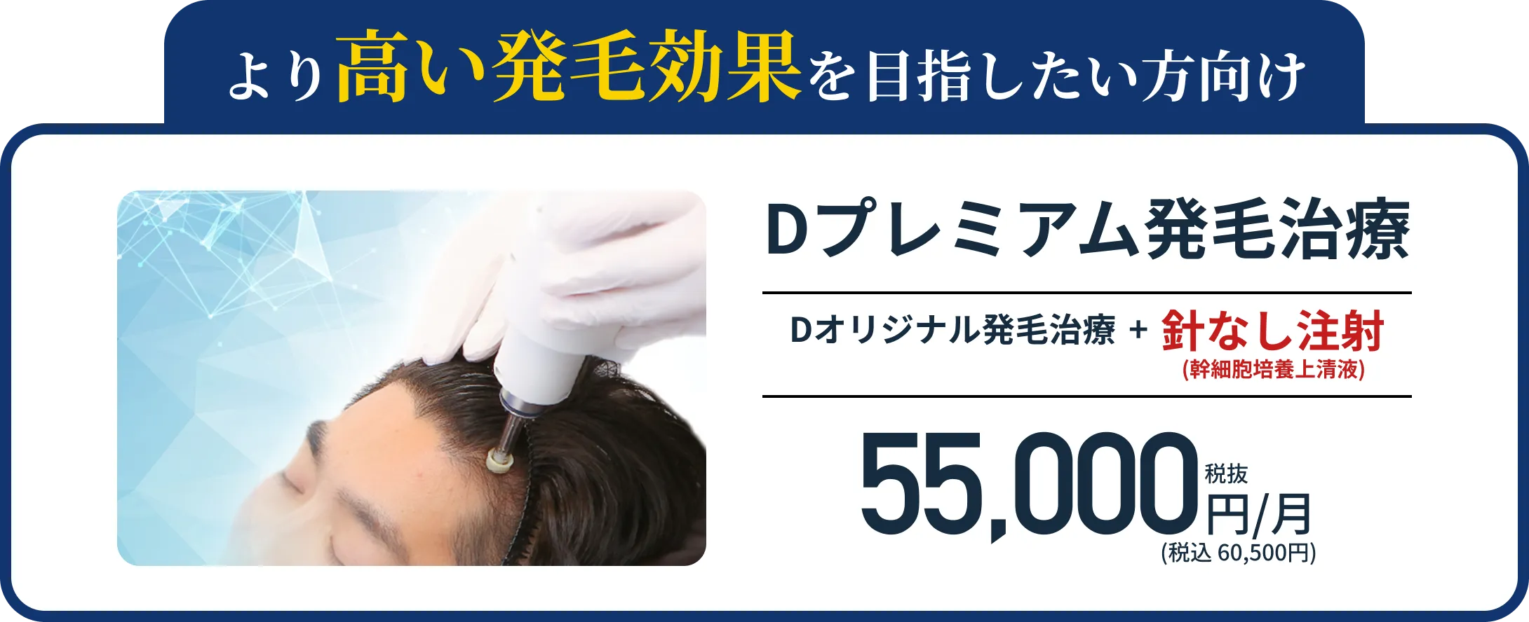 オプション治療も50%OFF