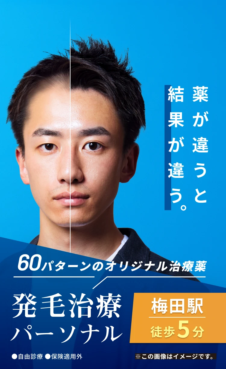 パーソナル発毛治療