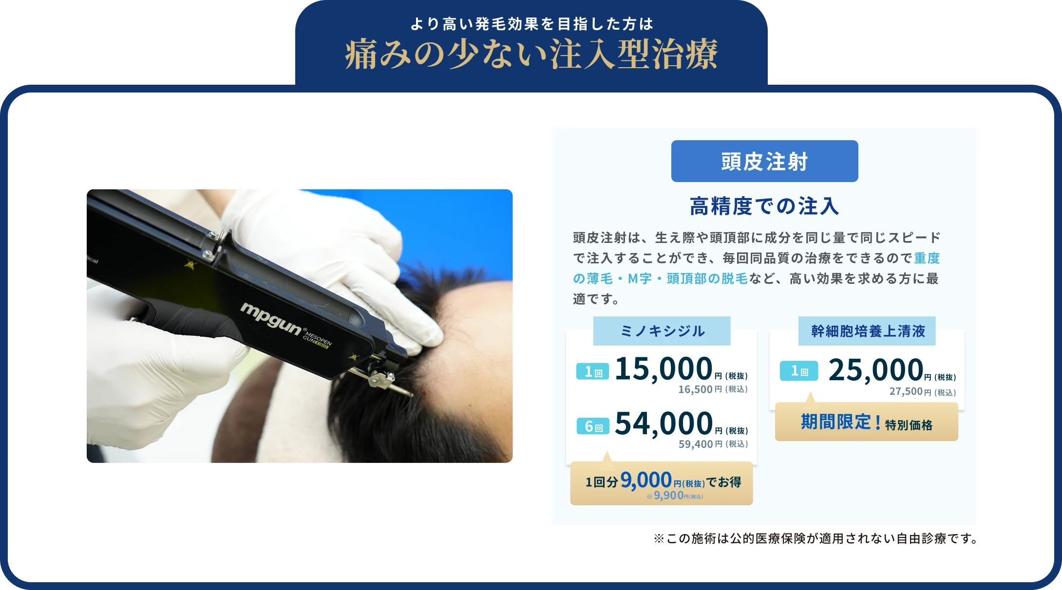 オプション治療も50%OFF