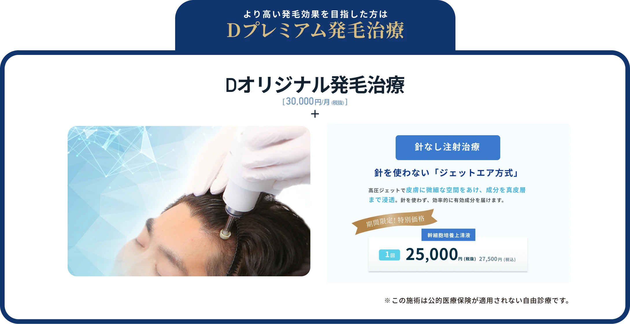 オプション治療も50%OFF