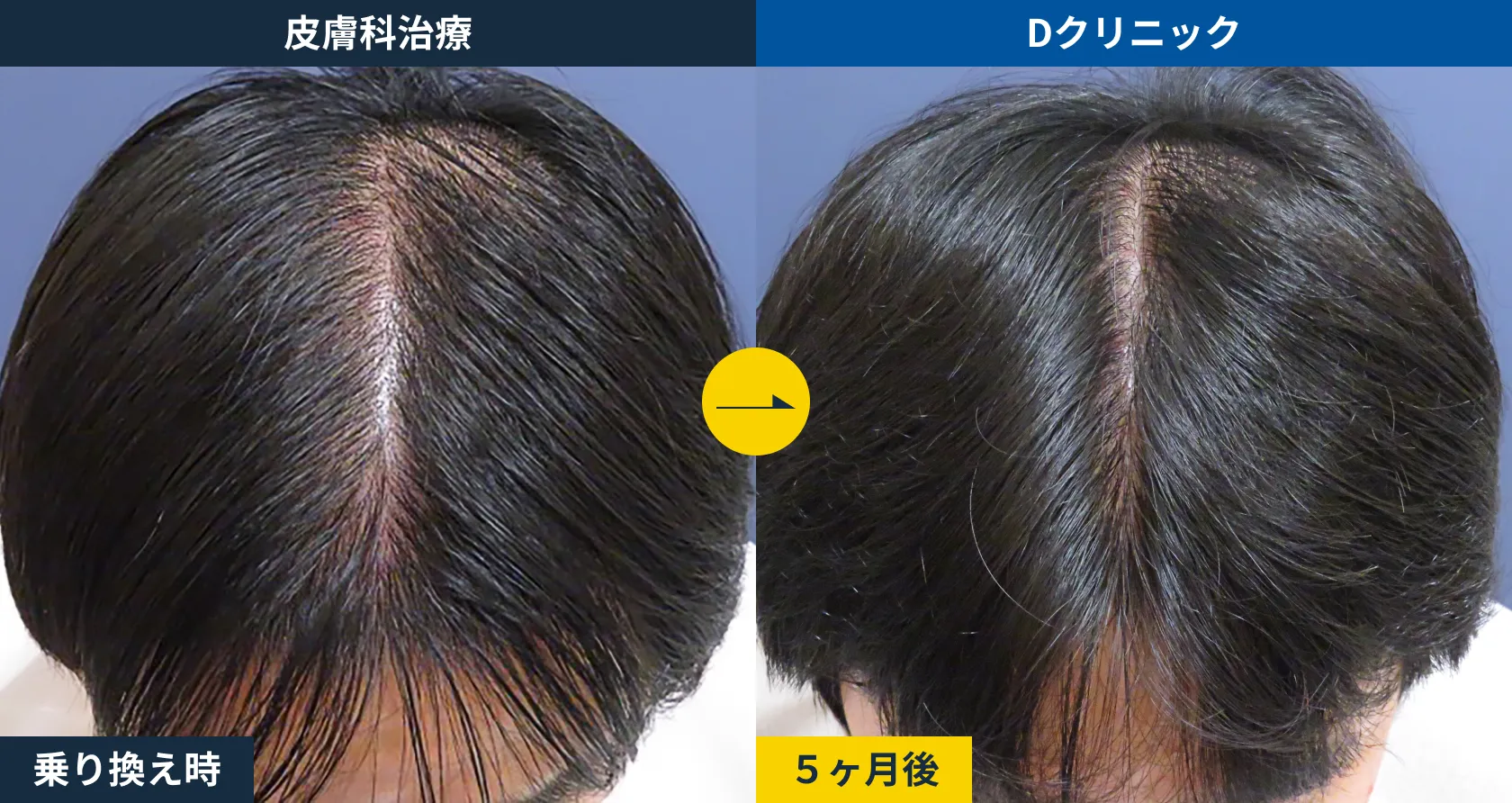 皮膚科治療からの乗り換え(30代)