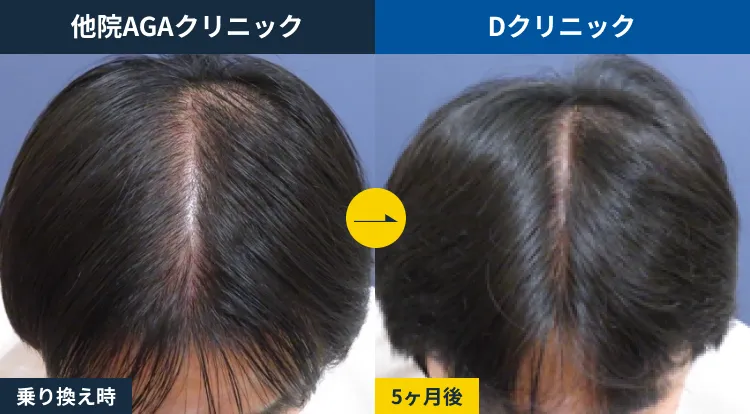 皮膚科治療からの乗り換え(30代)