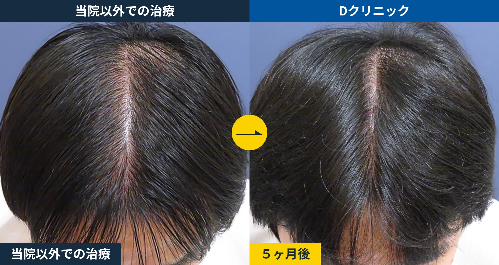 皮膚科治療からの乗り換え(30代)