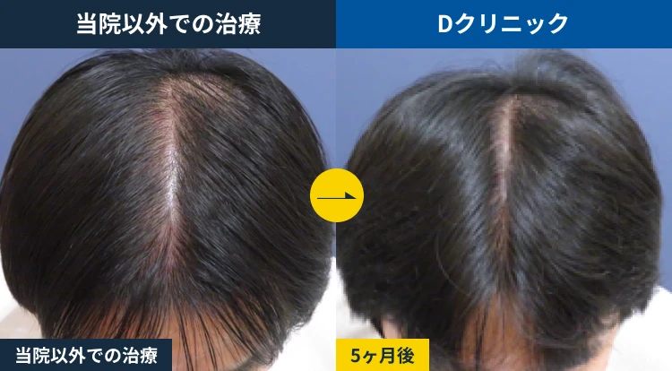 皮膚科治療からの乗り換え(30代)