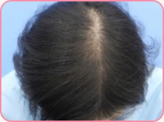 20代女性の場合