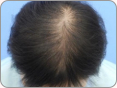 20代女性の場合