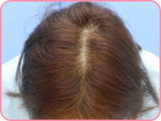 40代女性の場合