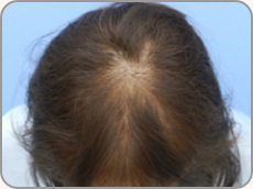 40代女性の場合