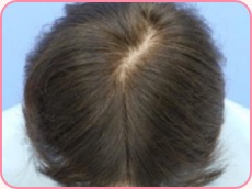 20代女性の場合