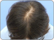 20代女性の場合